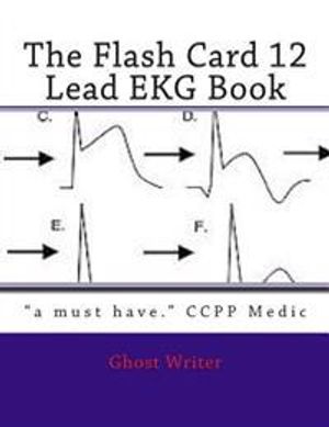 The Flash Card 12 Lead EKG