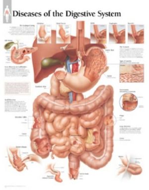 Diseases of the Digestive System Laminated Poster