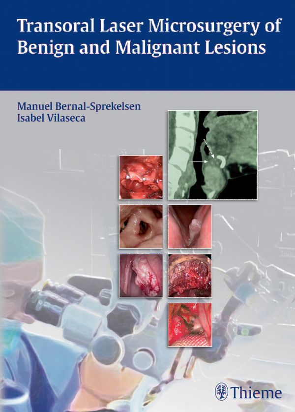 Transoral Laser Microsurgery of Benign and Malignant Lesions | 0:e upplagan