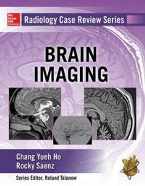 Radiology Case Review Series: Brain Imaging