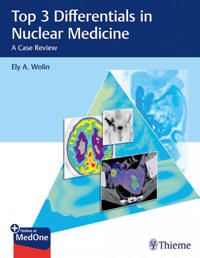 Top 3 Differentials in Nuclear Medicine | 0:e upplagan
