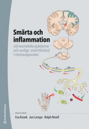 Smärta och inflammation - vid reumatiska sjukdomar och vanliga smärttillstånd i rörelseapparaten |  2:e upplagan