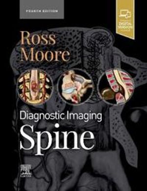 Diagnostic Imaging: Spine | 4:e upplagan