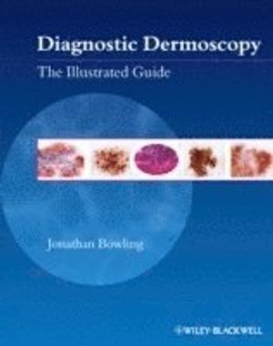 Diagnostic Dermoscopy: The Illustrated Guide | 1:a upplagan