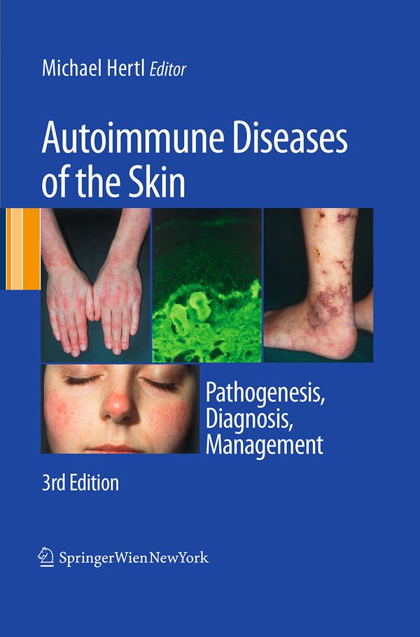 Autoimmune Diseases of the Skin | 3:e upplagan