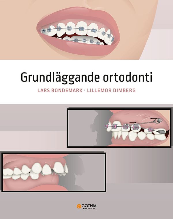 Grundläggande ortodonti | 1:a upplagan
