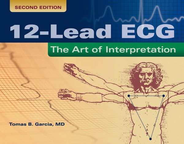12-Lead ECG: The Art of Interpretation | 2:a upplagan