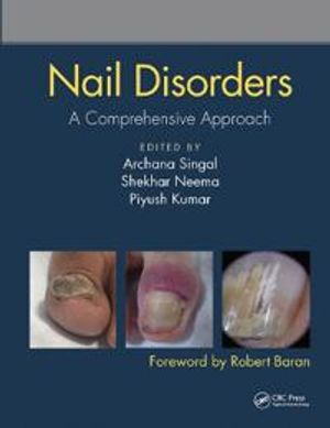 Nail Disorders | 1:a upplagan