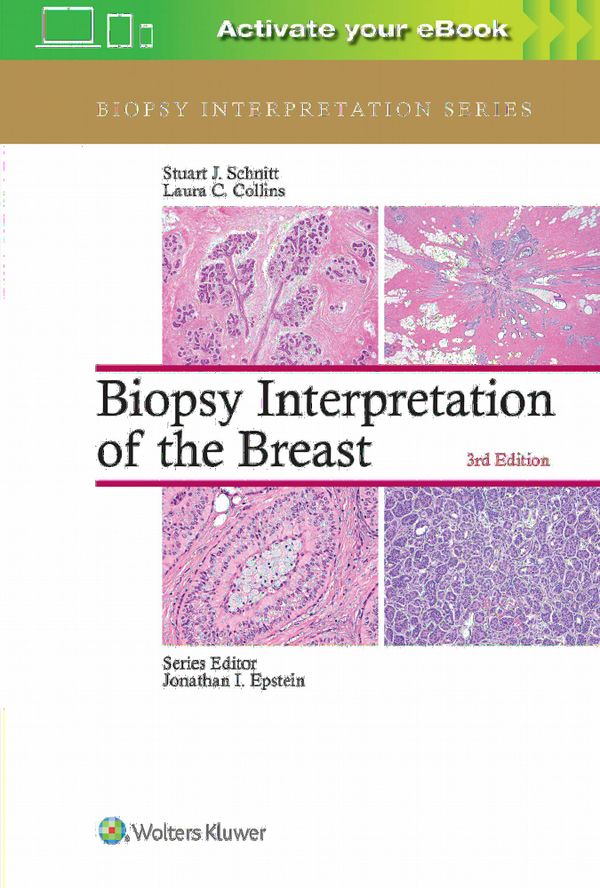 Biopsy Interpretation of the Breast | 0:e upplagan