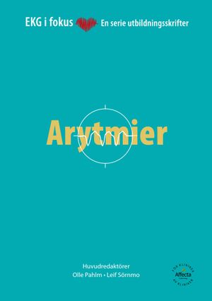 EKG i Fokus: Arytmier | 1:a upplagan