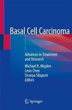 Basal Cell Carcinoma: Advances in Treatment and Research | 1:a upplagan