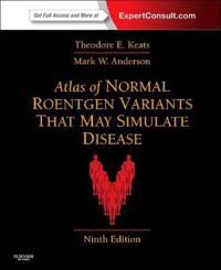 Atlas of Normal Roentgen Variants That May Simulate Disease | 9:e upplagan