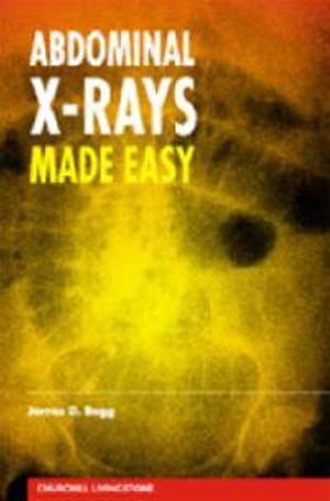 Abdominal X-Rays Made Easy