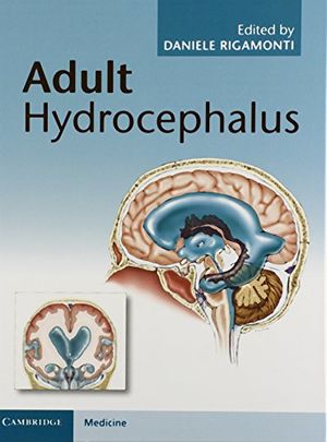 Adult Hydrocephalus