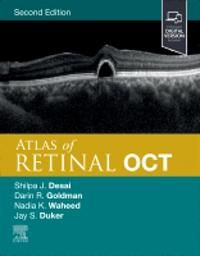Atlas of Retinal OCT | 2:a upplagan