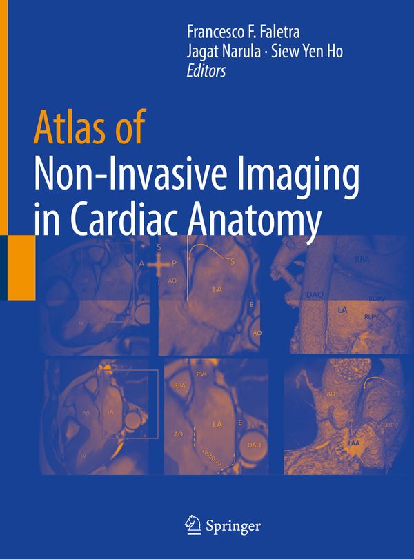 Atlas of Non-Invasive Imaging in Cardiac Anatomy | 1:a upplagan