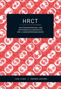 HRCT – Mustererkennung und Differentialdiagnostik von Lungenerkrankungen | 1:a upplagan