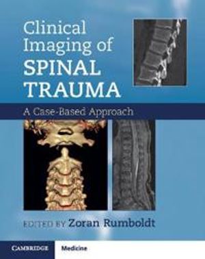 Clinical Imaging of Spinal Trauma