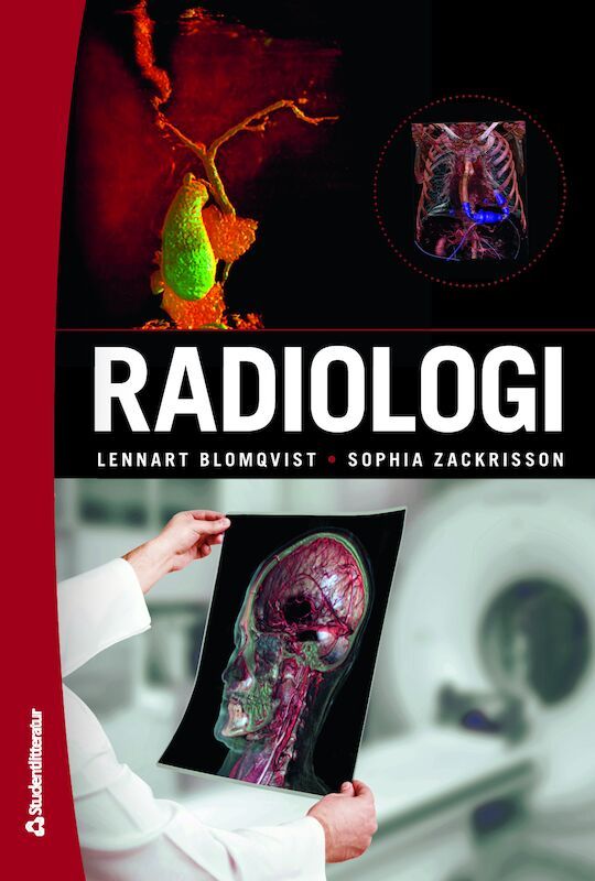 Radiologi - (bok + digital produkt) | 2:a upplagan
