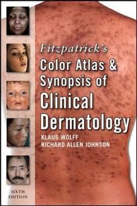 Fitzpatrick's Color Atlas and Synopsis of Clinical Dermatology: Sixth Edition