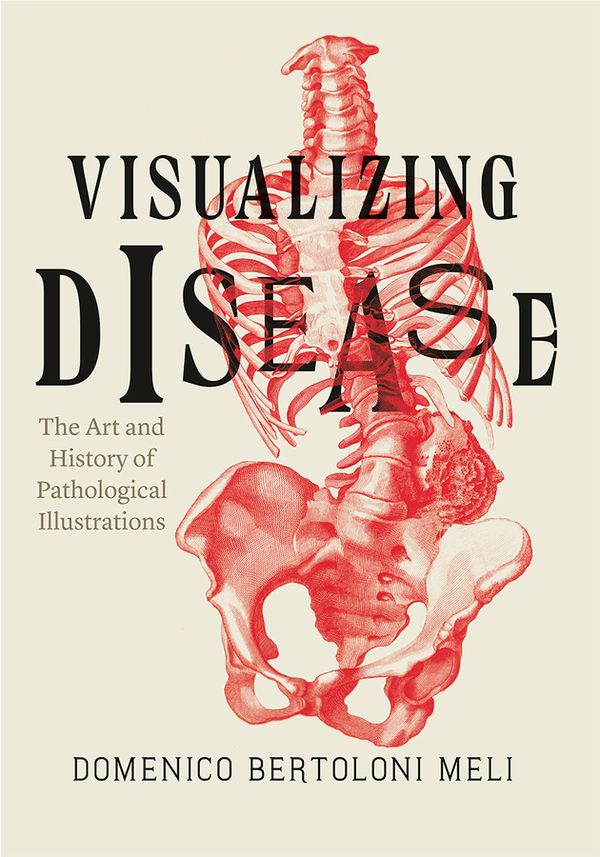 Visualizing Disease: The Art and History of Pathological Illustrations | 0:e upplagan
