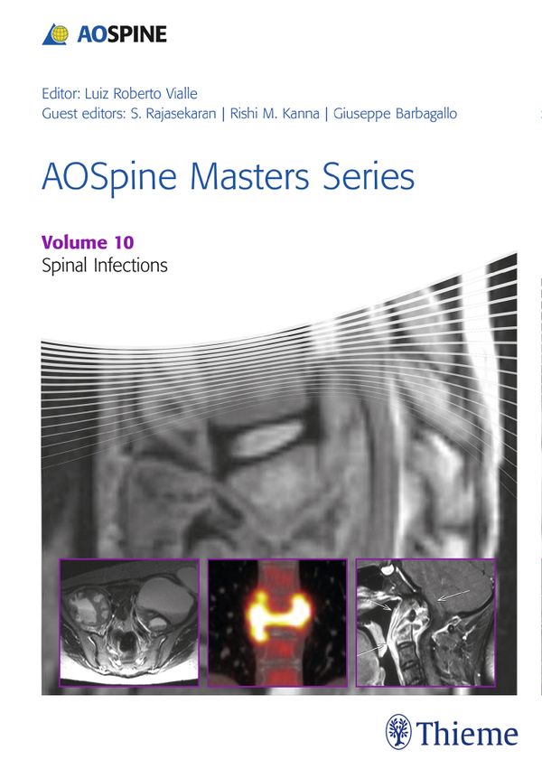 AOSpine Masters Series, Volume 10: Spinal Infections | 0:e upplagan