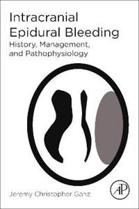 Intracranial epidural bleeding - history, management, and pathophysiology | 0:e upplagan