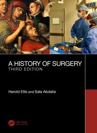 A History of Surgery | 3:e upplagan