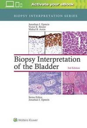 Biopsy Interpretation of the Bladder