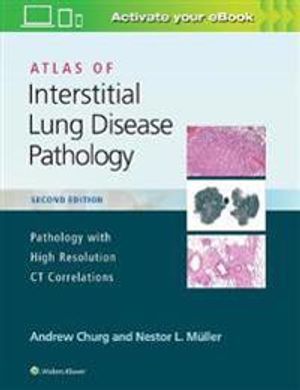 Atlas of Interstitial Lung Disease Pathology