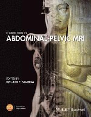 Abdominal-Pelvic MRI, 4th Edition | 1:a upplagan