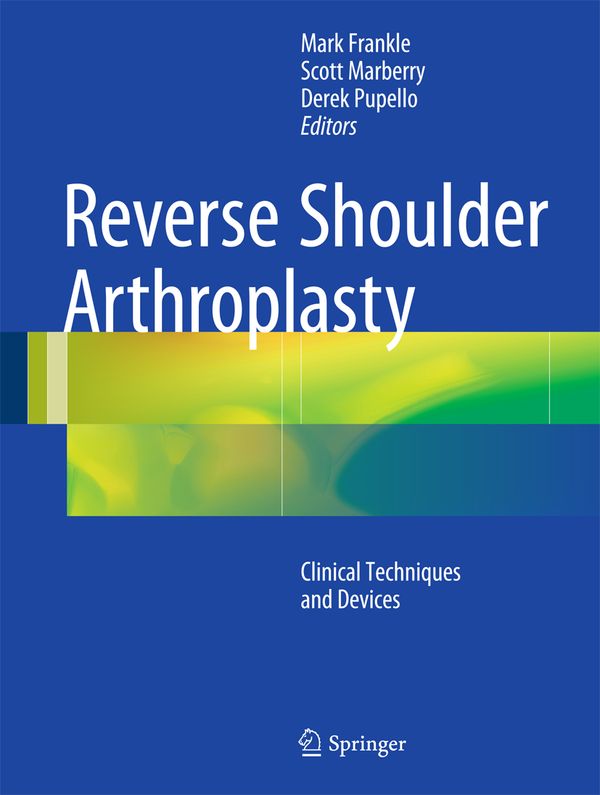 Reverse Shoulder Arthroplasty | 1:a upplagan
