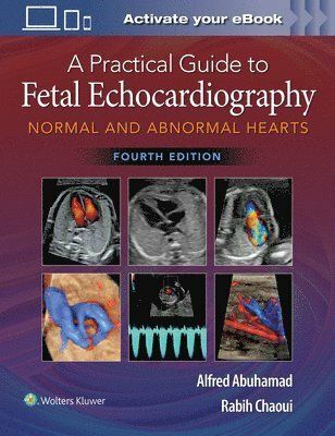 A Practical Guide to Fetal Echocardiography - Alfred Z. Abuhamad - Rabih Chaoui - Upplaga 4