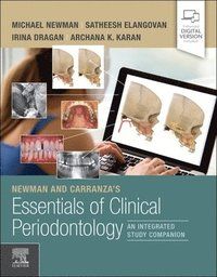 Newman and Carranza's Essentials of Clinical Periodontology