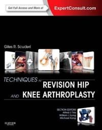 Techniques in revision hip and knee arthroplasty | 0:e upplagan