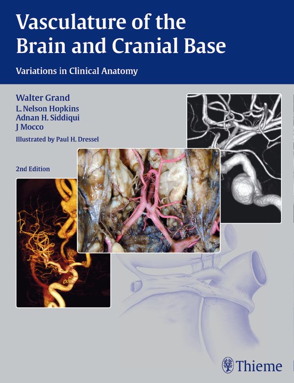 Vasculature of the Brain and Cranial Base | 2:a upplagan