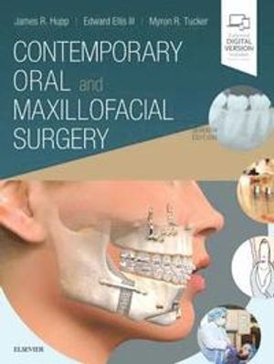 Contemporary Oral and Maxillofacial Surgery | 7:e upplagan