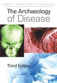 The Archaeology of Disease | 3:e upplagan