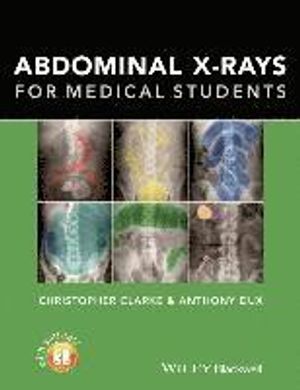 Abdominal X-rays for Medical Students | 1:a upplagan