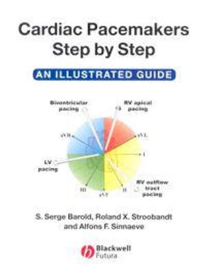 Cardiac Pacemakers Step-by-Step: An Illustrated Guide | 1:a upplagan