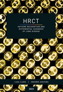 HRCT – Pattern Recognition and Differential Diagnosis of Lung Disease