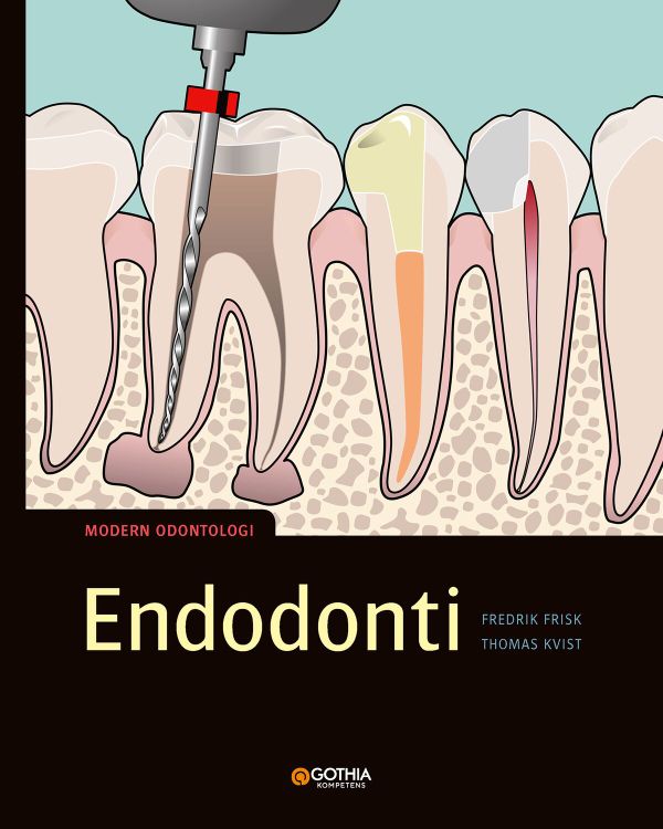 Endodonti | 1:a upplagan