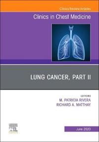 Lung Cancer, Part II, An Issue of Clinics in Chest Medicine | 0:e upplagan
