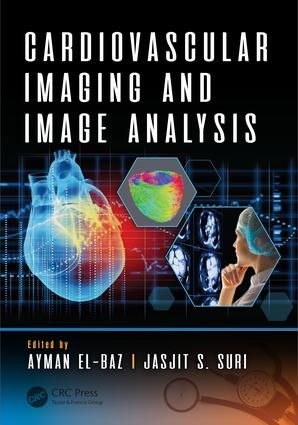 Cardiovascular Imaging and Image Analysis | 1:a upplagan