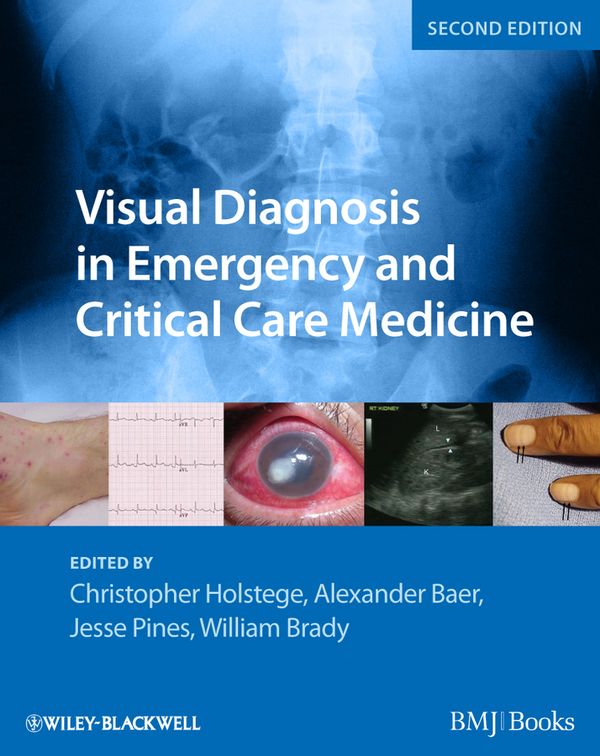 Visual Diagnosis in Emergency and Critical Care Medicine, 2nd Edition | 1:a upplagan