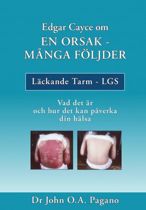 Edgar Cayce om En orsak - Många följder | 1:a upplagan