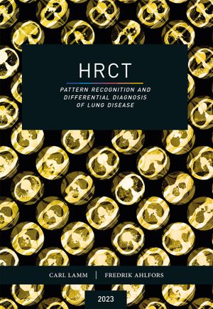 HRCT – Pattern Recognition and Differential Diagnosis of Lung Disease | 5:e upplagan