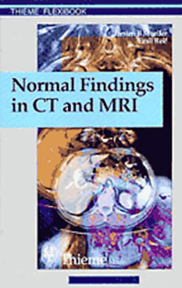 Normal Findings in CT and MRI, A1, Print | 0:e upplagan