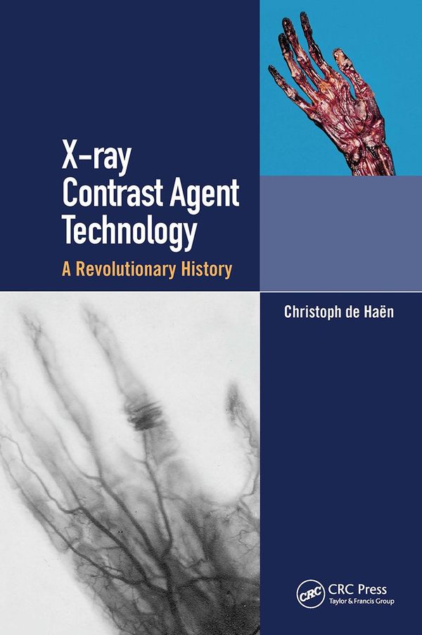 X-ray Contrast Agent Technology | 1:a upplagan