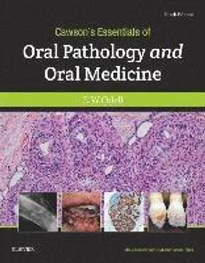 Cawsons essentials of oral pathology and oral medicine | 9:e upplagan